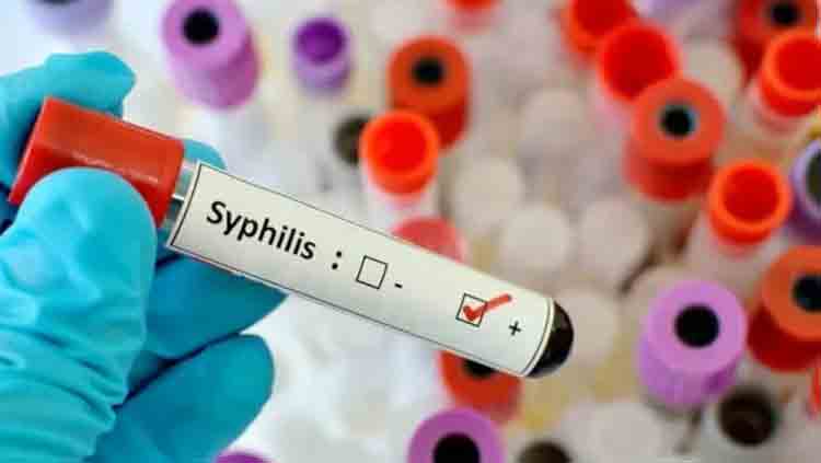 Sífilis en Entre Ríos: La tasa aumentó un 72% en 2025, superando el promedio nacional